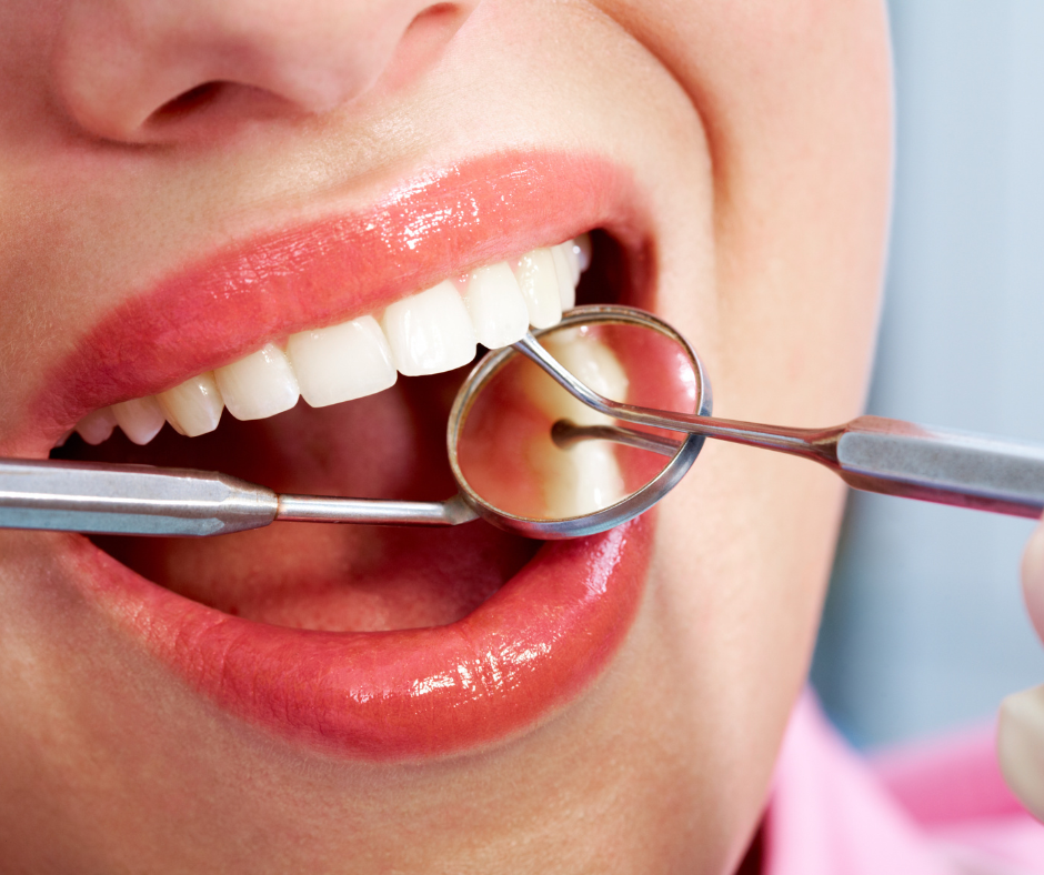 Why Am I Experiencing Pain After My Dental Filling?