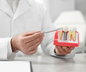 Dental Implants in Kansas City