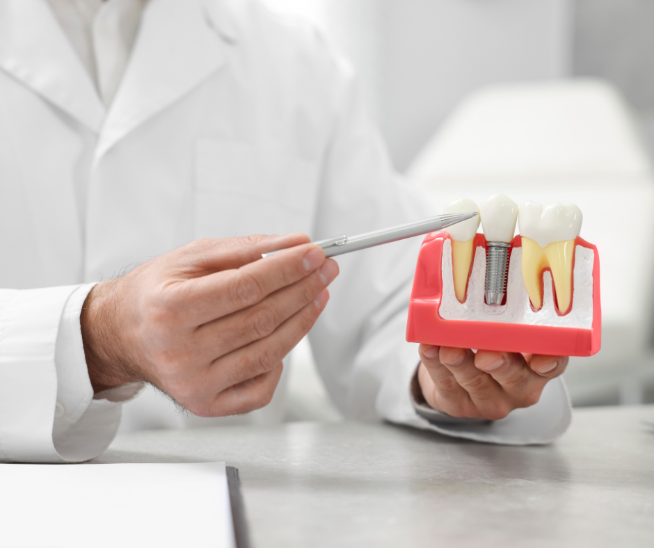 Dental Implants in Kansas City