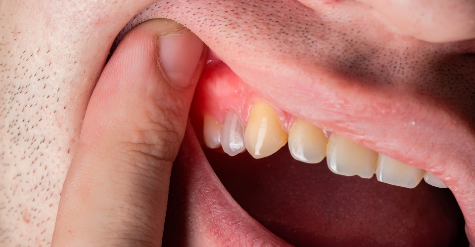 Emergency Dental of Kansas City