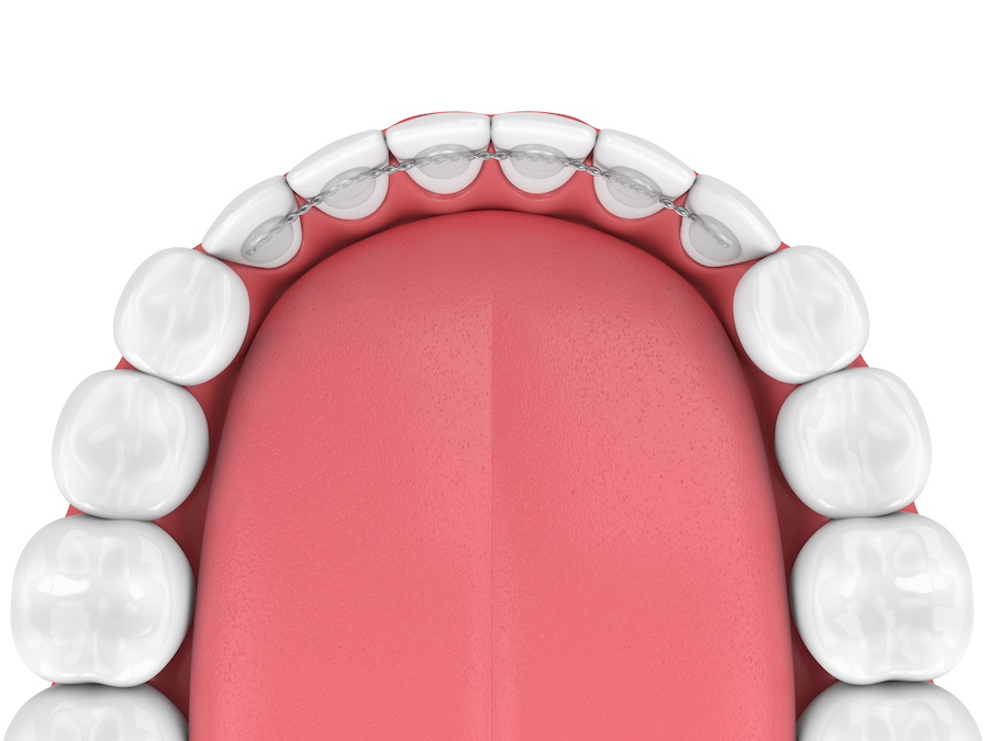 Emergency Dental of Kansas City